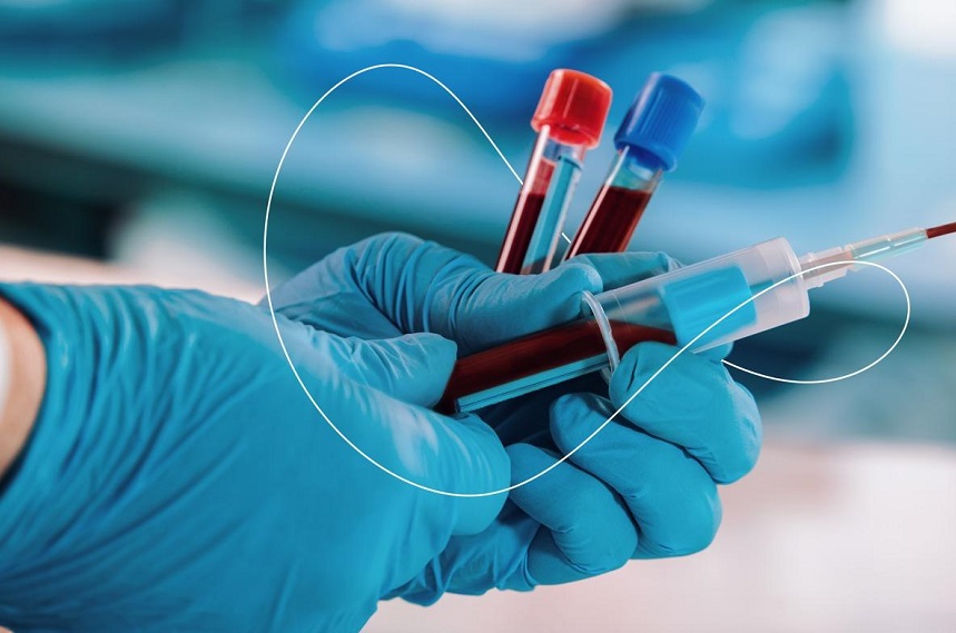 Un projet punit plus sévèrement les conjoints qui transmettent une maladie incurable à un partenaire