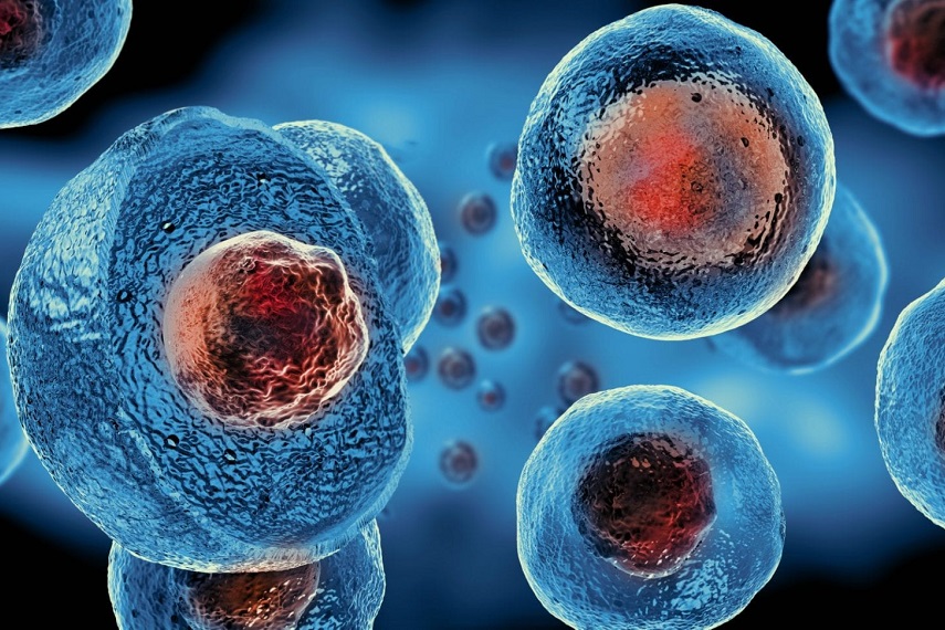 Le cancer touche de plus en plus de personnes de moins de 50 ans