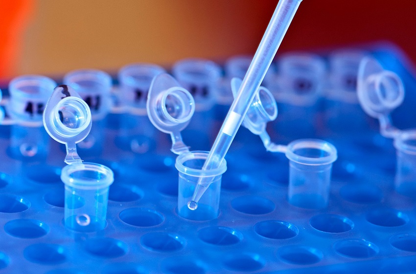 Biofast met en place des laboratoires de service dans les UPA
