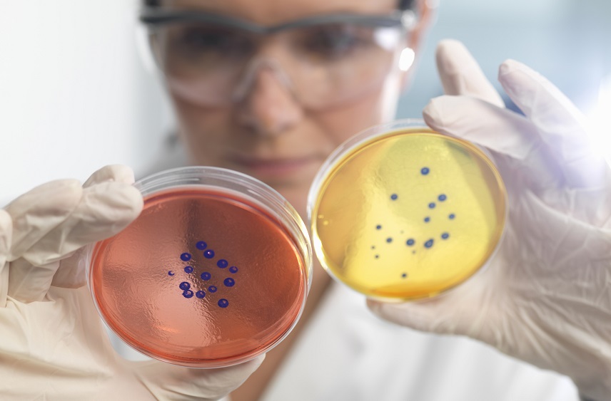 Santa Casa BH lance une technologie avancée axée sur le diagnostic microbiologique