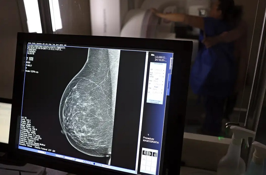 Environ 77 000 femmes attendent une mammographie via le SUS