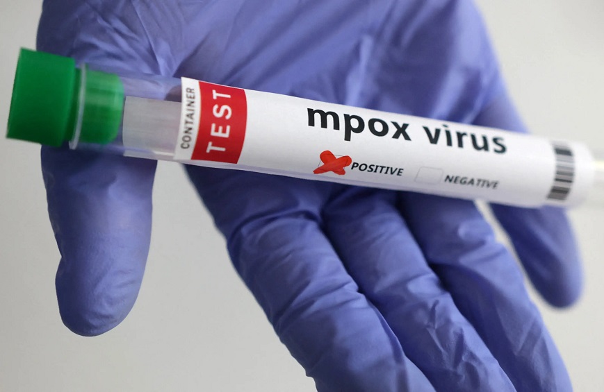 Mpox : l'OMS approuve le premier vaccin pour une utilisation d'urgence chez les enfants