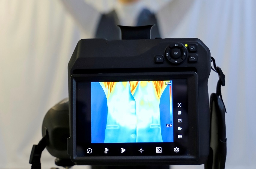 La thermographie peut rendre le cancer du sein plus accessible