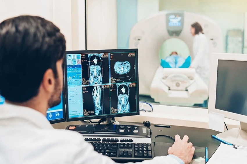 La publication met en évidence les progrès du diagnostic du cancer du rectum avec l'imagerie par résonance magnétique
