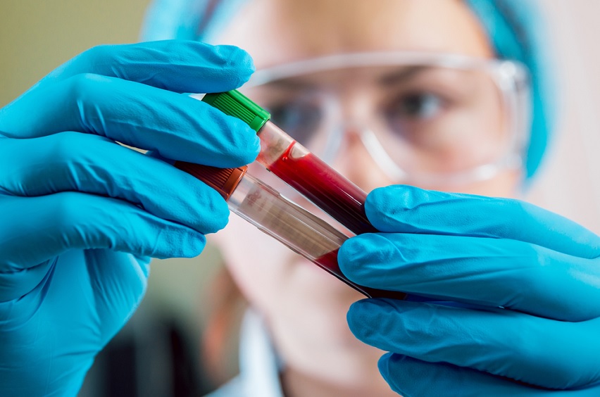 La recherche mlongera le voyage du patient atteint d'hémophilie au Brésil