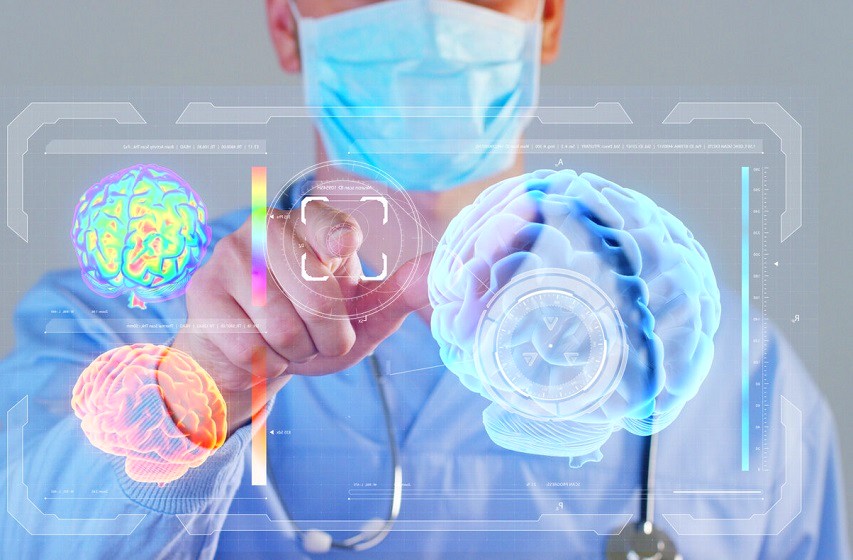 La plate-forme de stimulation cérébrale comblée IMA est le nouveau pari pour le traitement de l'épilepsie