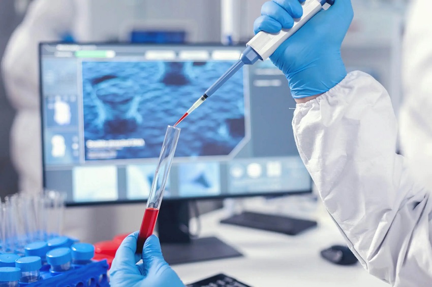 La recherche UFSCAR analyse le biomarqueur pour la détection d'Alzheimer