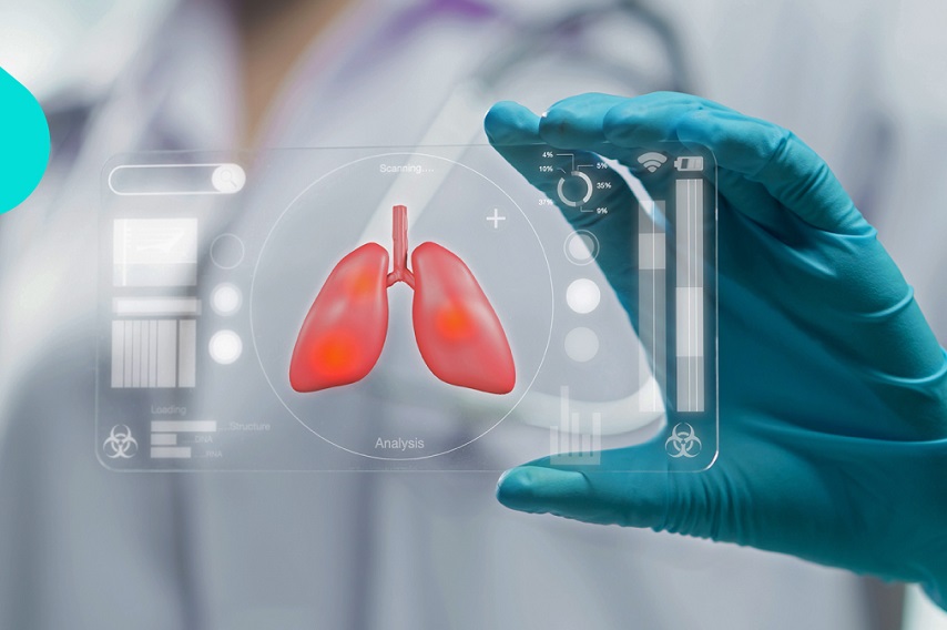 Badiothérapie profite 60% des patients atteints d'un cancer du poumon non opérable