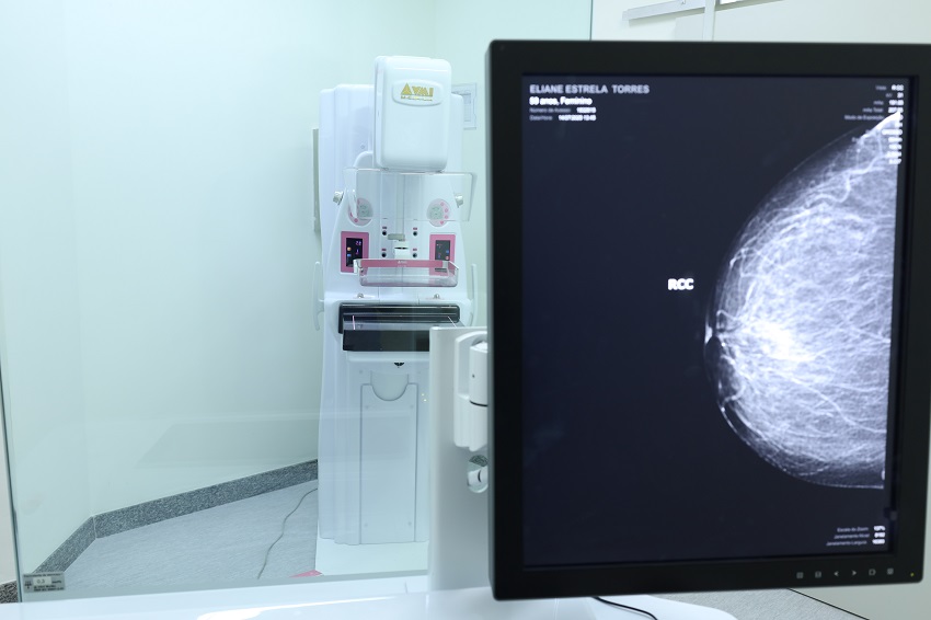 Santa Casa BH investit dans une nouvelle mammographe pour étendre la prévention