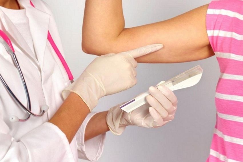 Les plans de santé devront offrir un implant contraceptif hormonal