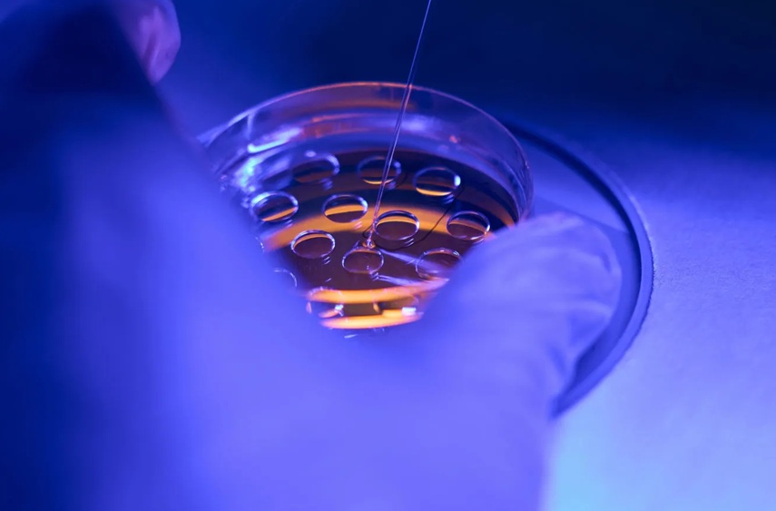 Fife of the Future: Comment l'IA révolutionne les traitements pour tomber enceinte