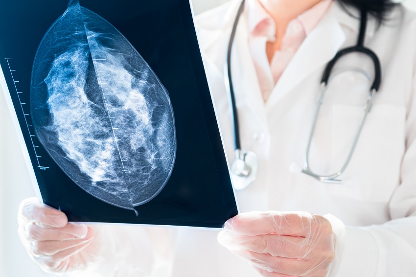 Le diagnostic d'image renforce le traitement personnalisé des DCI