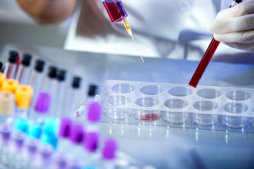 Fiocruz étendra la production de kits de diagnostic pour le SUS