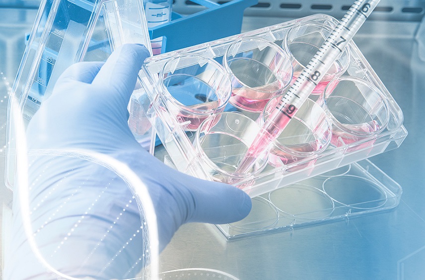 Un produit naturel brésilien démontre une activité anticancéreuse et renforce l'action des médicaments de chimiothérapie