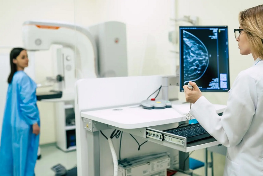 São Paulo devrait enregistrer plus de 20 000 nouveaux cas de cancer du sein cette année