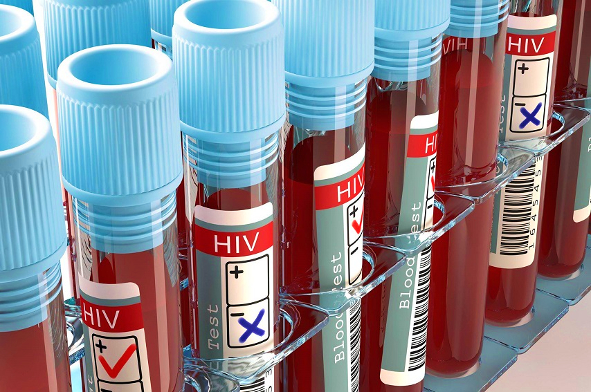 84 % des patients qui découvrent un VIH à un stade avancé sont hétérosexuels