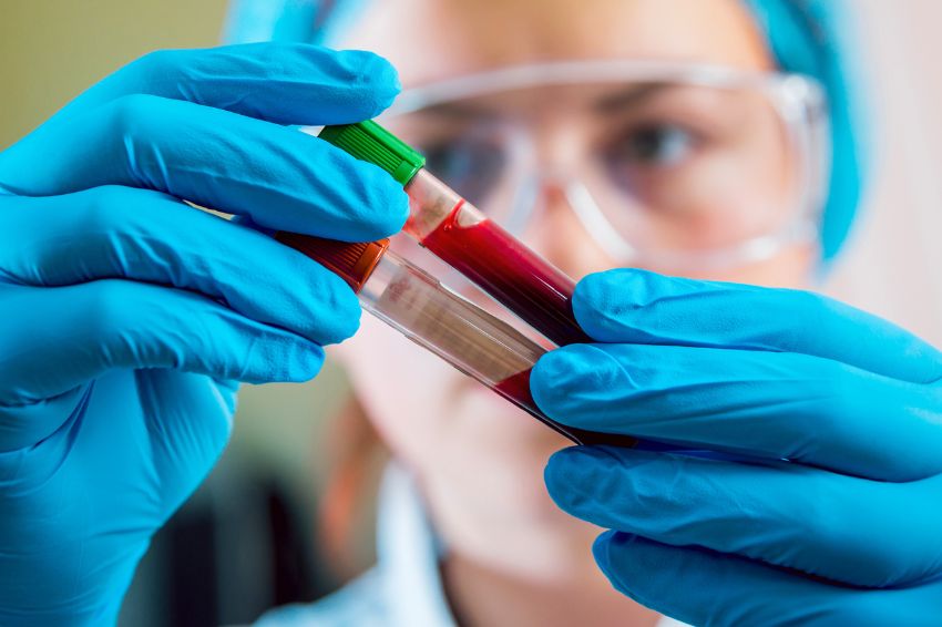 Einstein est le premier hôpital brésilien à adopter la biopsie liquide pour la détection précoce de plusieurs cancers